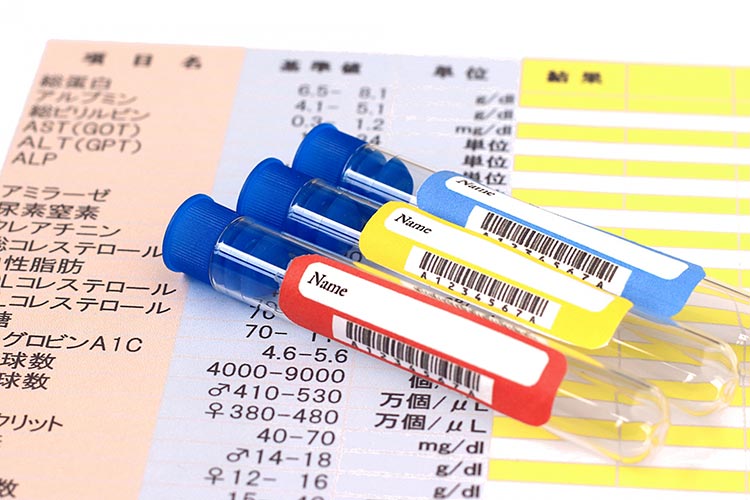 糖尿病網膜症イメージ